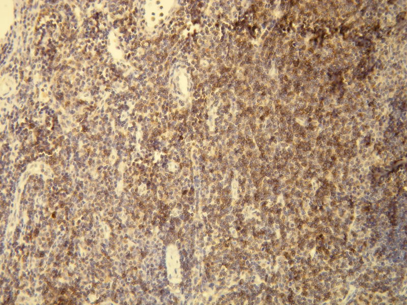 Anti-CD5 Antibody [A25-G] - Identical to Novus (NBP1-78994)