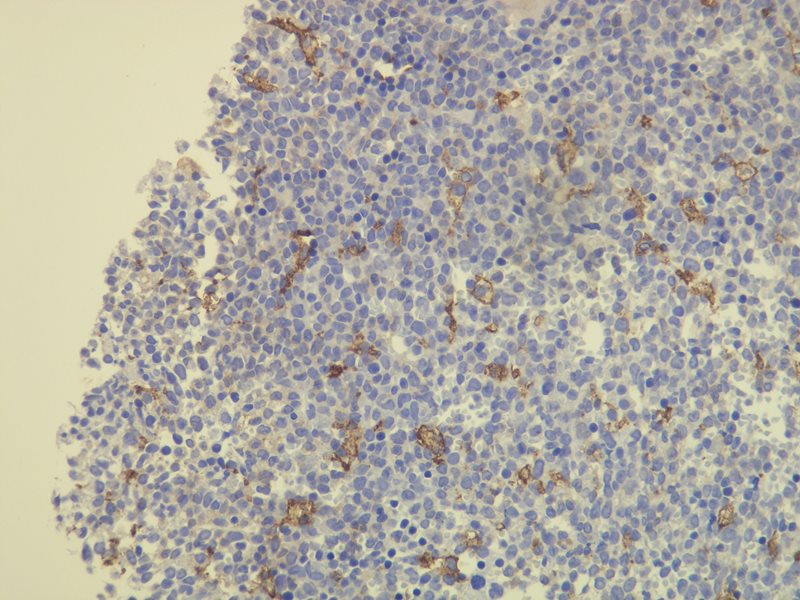 Anti-CD163 Antibody [K20-T] - Identical to Novus (NBP1-30148)