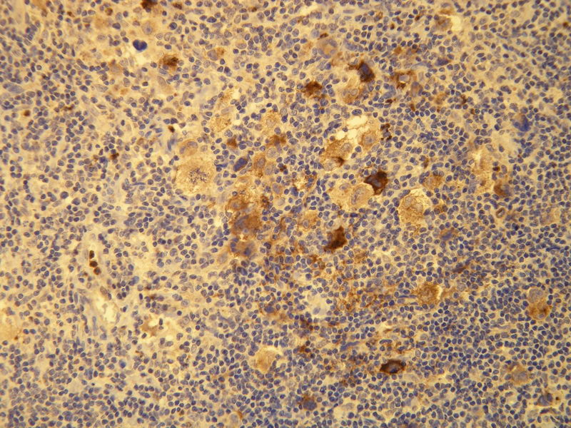 Anti-EBV Antibody [D24-G] - Identical to Abcam (ab136633)