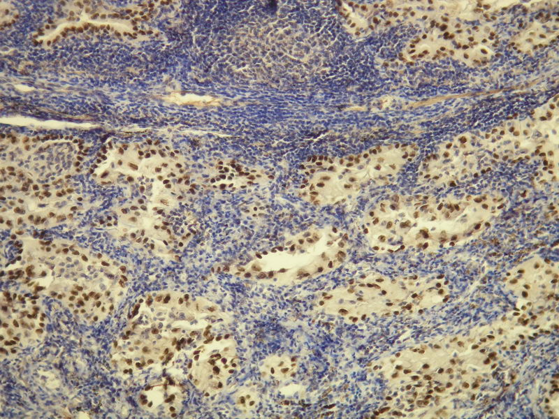 Anti-TTF-1 Antibody [G21-G] - Identical to Novus (NBP1-79056)