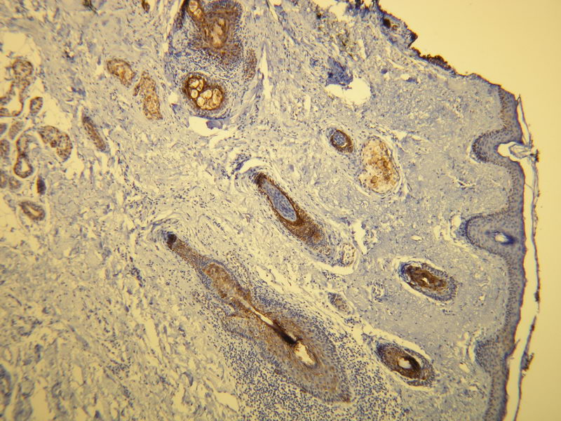 Anti-Cytokeratin 17 Antibody [V21-R] - Identical to Novus (NBP1-79071)