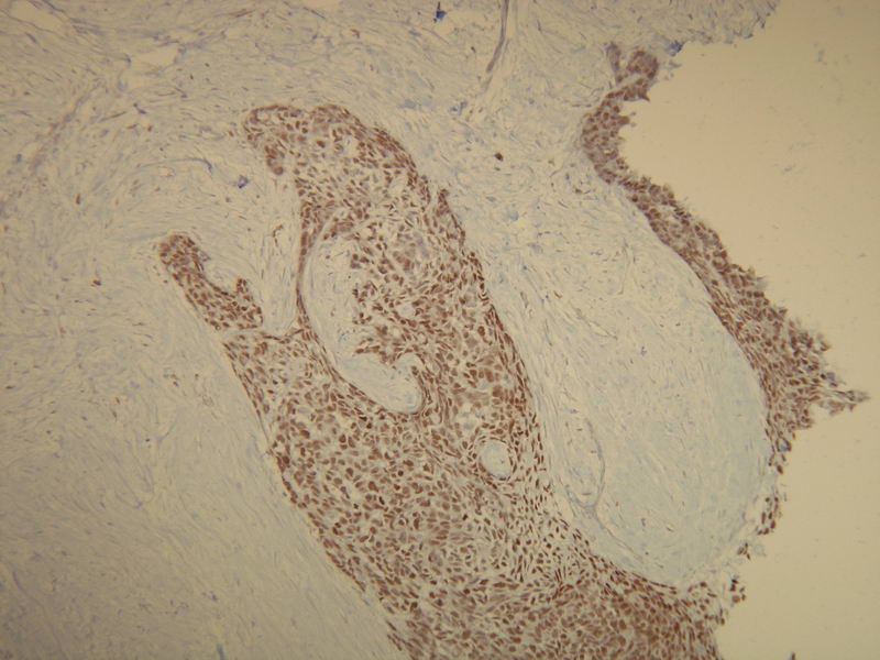 Anti-p63 Antibody [V22-E]