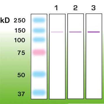 Anti-Nephrin Antibody [G17-H] - Identical to Abcam (ab136927) and Novus (NBP1-30137)