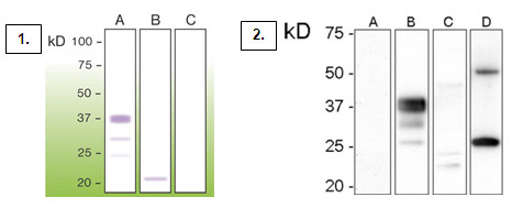 Anti-Prion Antibody [T16-R]