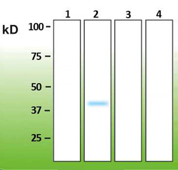 Anti-p38 beta Antibody [E13-Q]