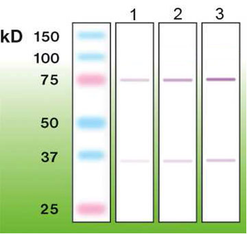 Anti-c-FOS Antibody [F14-R]