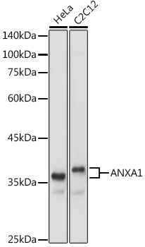 Anti-Annexin A1 / ANXA1 Antibody