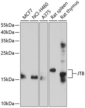 Anti-JTB Antibody