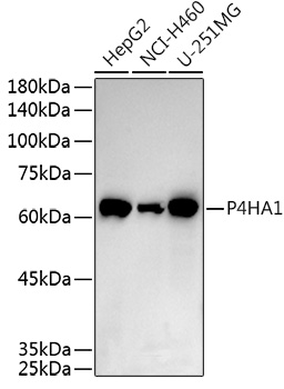 Anti-P4HA1 Antibody