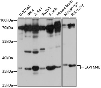 Anti-LAPTM4B Antibody