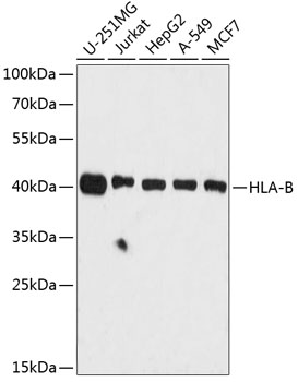 Anti-HLA Class 1 ABC Antibody