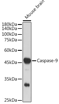 Anti-Caspase-9 Antibody [ARC5016-10]