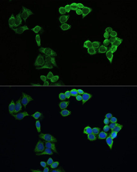 Anti-Amyloid Precursor Protein Antibody