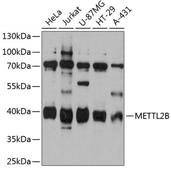 Anti-METTL2B Antibody