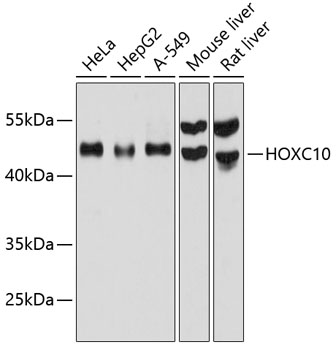 Anti-HOXC10 Antibody