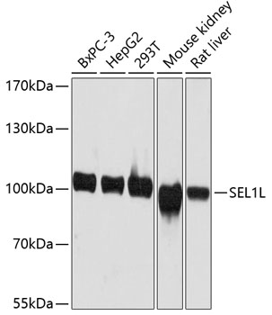 Anti-SEL1L Antibody