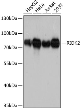 Anti-RIO2 Antibody