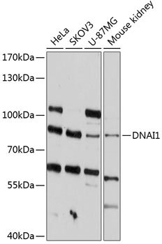 Anti-Dynein intermediate chain 1 / DNAI1 Antibody