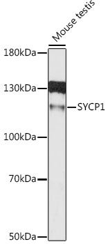 Anti-SCP1 Antibody