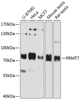 Anti-PRMT7 Antibody