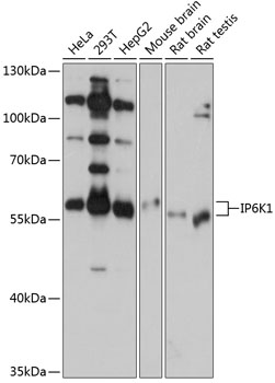 Anti-IP6K1 Antibody