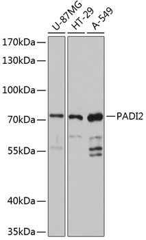 Anti-PADI2 / PAD2 Antibody