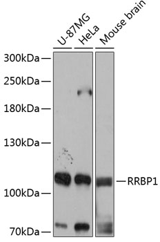 Anti-RRBP1 Antibody