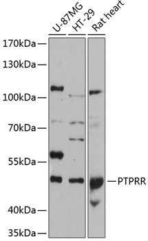 Anti-PCPTP1 / PTPRQ Antibody