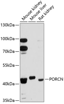 Anti-PORCN / PPN Antibody