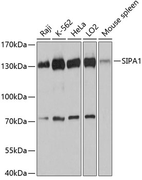 Anti-Spa-1 Antibody