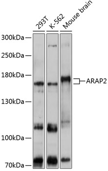 Anti-ARAP2 Antibody