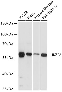 Anti-ZNFN1A2 / HELIOS Antibody