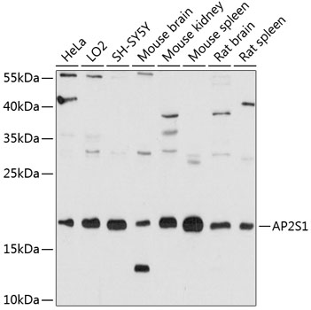 Anti-AP2S1 Antibody
