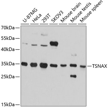 Anti-TRAX Antibody