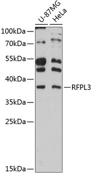 Anti-RFPL3 Antibody