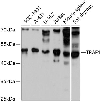 Anti-TRAF1 Antibody