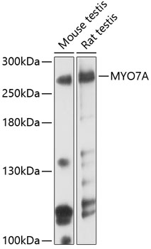 Anti-Myosin VIIa / MYO7A Antibody