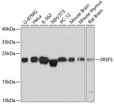 Anti-SRSF3 Antibody