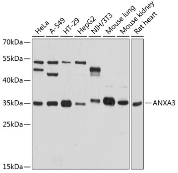 Anti-Annexin A3 / ANXA3 Antibody