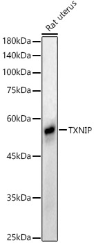 Anti-TXNIP Antibody