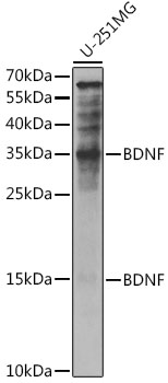 Anti-BDNF Antibody