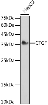 Anti-CTGF Antibody