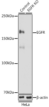 Anti-EGFR Antibody