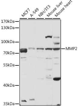 Anti-MMP2 Antibody