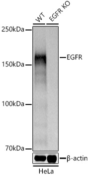 Anti-EGFR Antibody