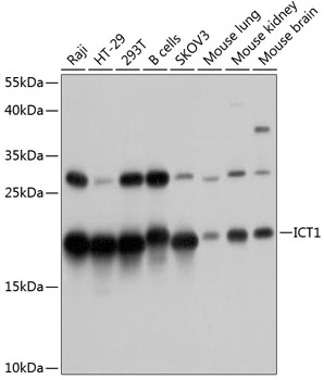 Anti-DS-1 Antibody