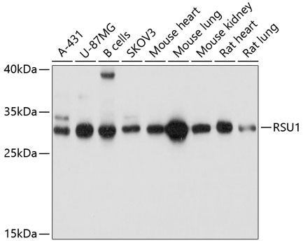 Anti-RSU1 Antibody