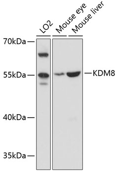 Anti-JMJD5 Antibody