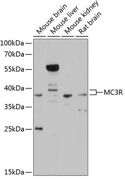 Anti-MC3-R Antibody