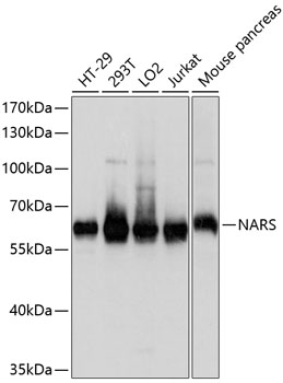 Anti-NARS Antibody